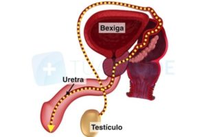 Eyaculación retrógrada que es síntomas y tratamiento Maestria Salud