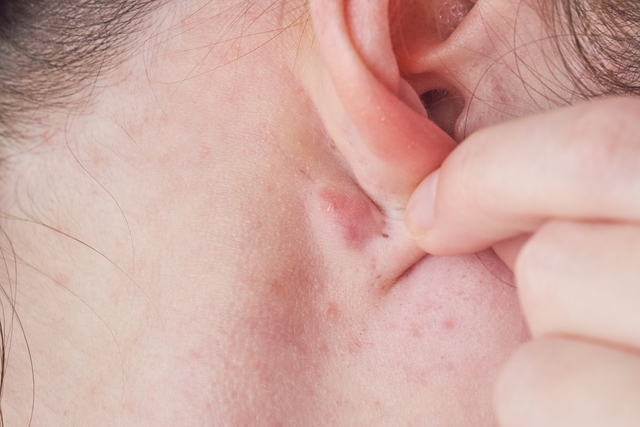 hard-lump-behind-the-ear-6-causes-what-to-do-maestria-salud